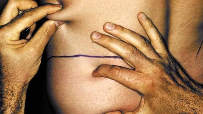 Doctors Warn of Rare But Serious Liposuction Complication