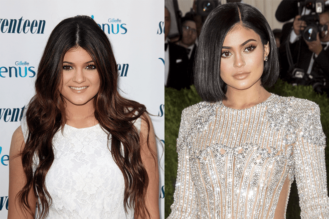 This Is What It’s Really Like to Plan a Secret Celebrity Plastic Surgery Appointment