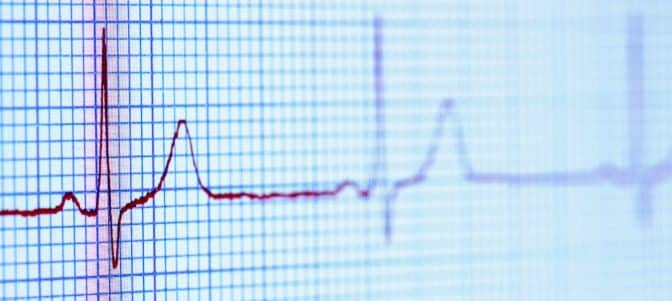 Study Suggests Botox May Help Prevent AFib After Heart Surgery
