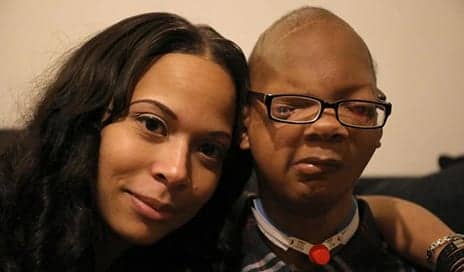 Kids with Craniofacial Conditions Hope Film ‘Wonder’ Will Nurture Awareness in Others