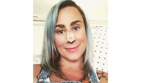 Mom Credits “Selfie Dysmorphia” for Her Plastic Surgery Addiction