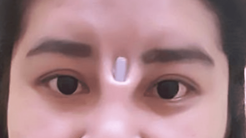 Thai Woman Shows Off Just How Bad A Botched Nose Job Can Look