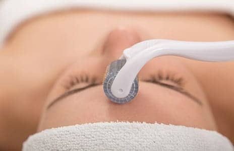 The FDA May Soon Regulate At-Home Microneedling on Skin