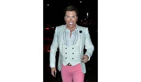 Human Ken Doll Has Four Ribs Removed to Get a Slimmer Waist
