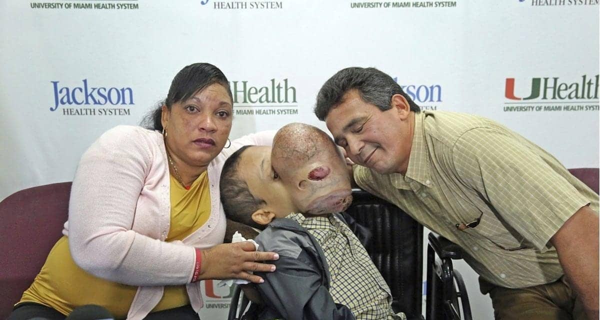 Boy with 10-Pound Facial Tumor Dies After Surgery