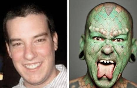Regular People Reveal What They Looked Like Before Undergoing Extreme Plastic Surgery