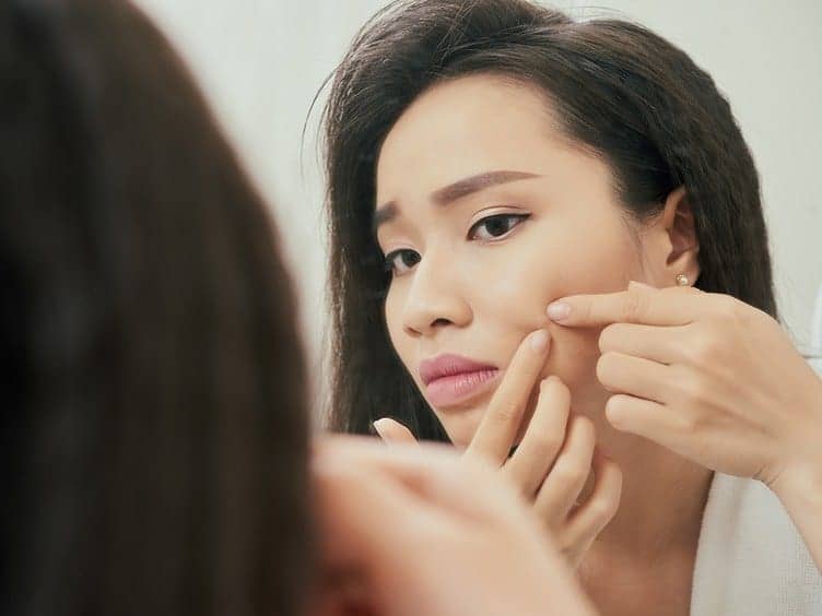 Is Popping Your Pimples Really That Bad?