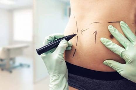 You Won’t Believe How Much People Pay for These Extreme Plastic Surgeries