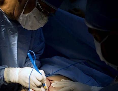 Many Women Have Become Seriously Ill After Undergoing Plastic Surgery In These Countries