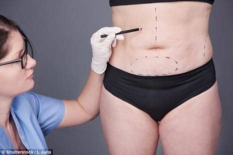 Nips and Tucks Without the Knives