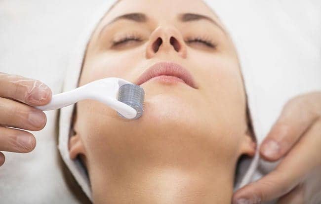 I Tried Microneedling To Stimulate Collagen In My Face—Here’s What Happened