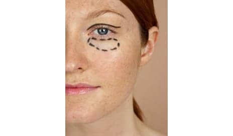 Plastic Surgery Trends for 2018 Are Being Shaped by Social Media