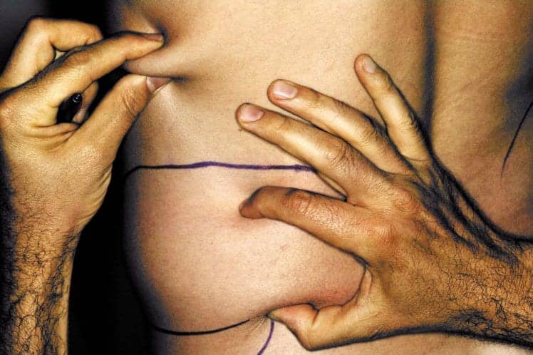 Botched Plastic Surgery Abroad is Costing the NHS Millions