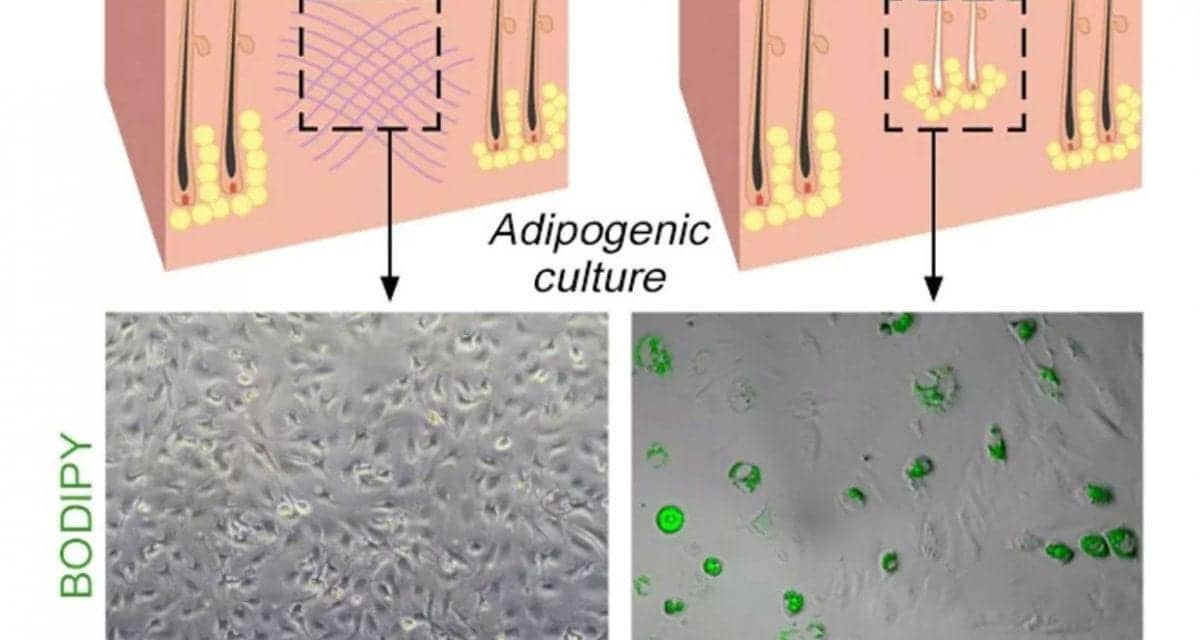 A New Discovery About Human Skin Could Help Us Eliminate Scarring