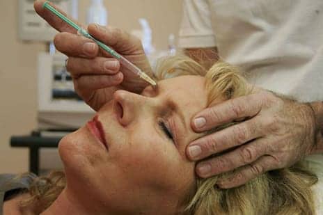 Everything You Need to Know About Botox Before You Try It