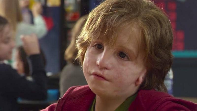 Different, Not Emotionless: The Ugly Psychological Truth About Facial Disfigurements