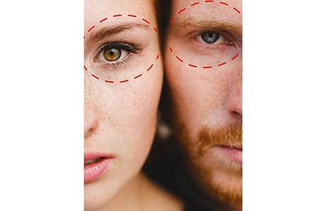 Why “Beauty Matching” Is the New Plastic Surgery Trend Rising Among Couples