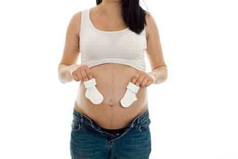 More Than Just a Cosmetic Procedure – 'Tummy Tuck' Reduces Back Pain and Incontinence