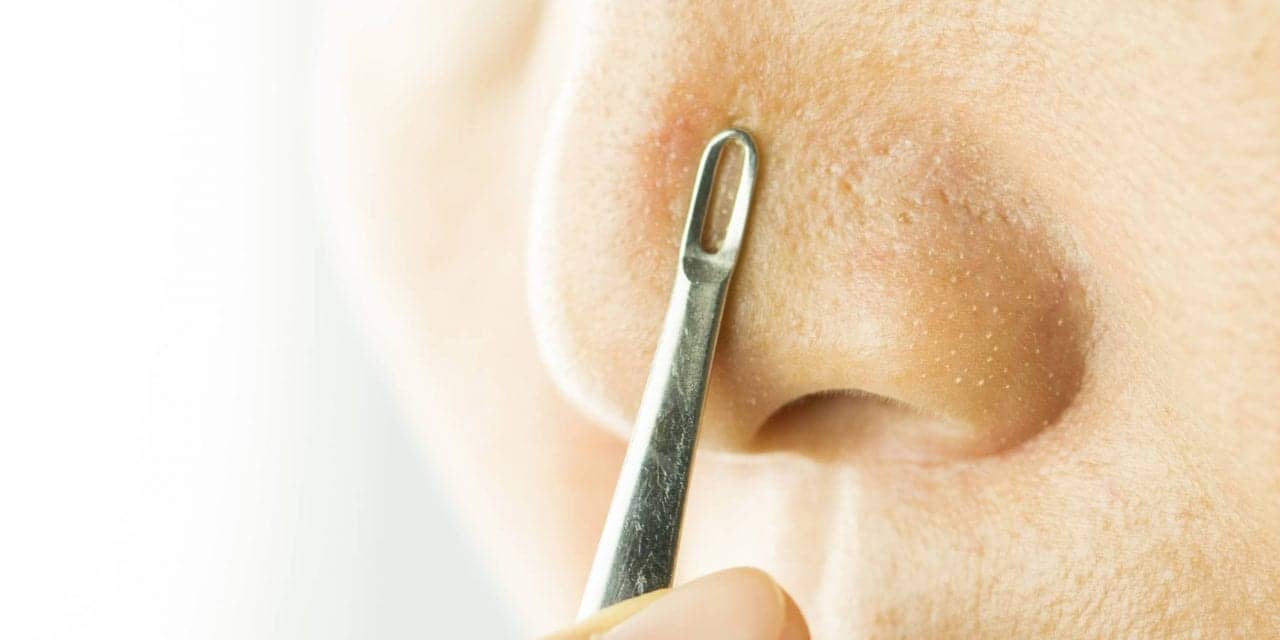 Blackheads Dos and Don’ts — How to Fix This Common Skin Problem