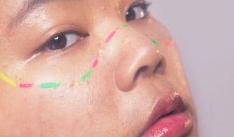 Acne Treatment Used to Include Poisoning Yourself a Lot
