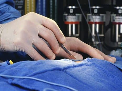 Seeking Cheaper Plastic Surgery Abroad? Buyer Beware