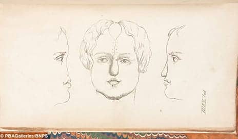 Rare Book Reveals How Pioneering Plastic Surgeon Achieved Mastery of Rhinoplasty 185 Years Ago