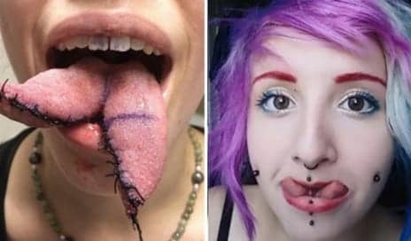 Tongue Splitting, Bodily Harm, and Human Dignity