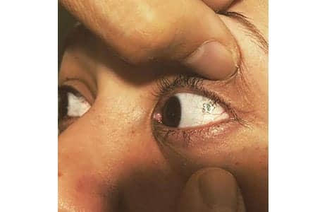 You Can Now Get Jewelry Inserted Into Your Eyeball – Any Takers?