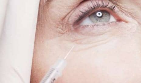 Hyaluronidase Can Remove Hyaluronic Acid Fillers in Cosmetic Dermatology