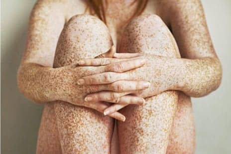 Should You Stop Wearing Sunscreen To Get More Vitamin D? Here’s What a Doctor Says