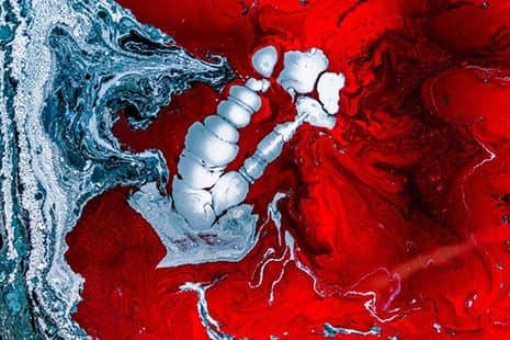 Why Older People Are Using the Blood of Teenagers to Live Longer