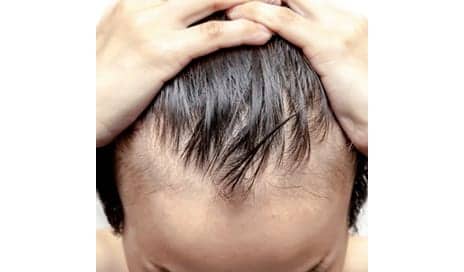 Food For Hair