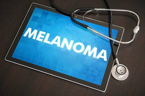 Melanoma Risk Greater for Middle-Aged Men Than Women. Here’s Why