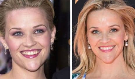 Reese Witherspoon Hasn’t Aged Since the Original ‘Legally Blonde’—Here’s Why