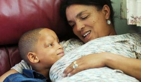 Bringing a Smile to Boy, 6, Through Skull Surgery