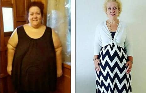 Single Mother, 42, Who Sent a Tinder Match Very Candid Photos of Her Excess Skin After Shedding 18 Stone Says She 'Doesn't Blame' Him for Rejecting Her