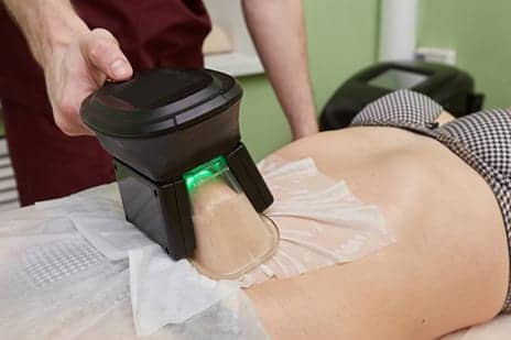 Complication of ‘Fat Freezing’ Procedure May Be More Common Than Thought