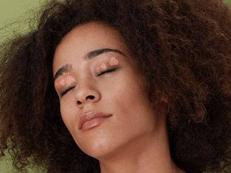 Here’s Exactly What to Do About Eczema on Your Eyelid