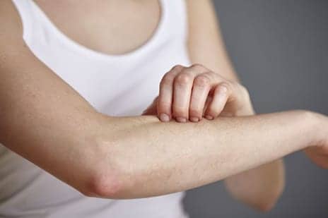 This Dermatologist Has a Weird Hack for Summer Rashes