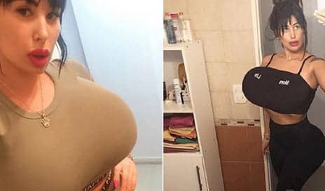 Woman Who Has Spent $20,000 On Plastic Surgery Now Claims She Cannot Lie On Her Front Or Take Public Transport
