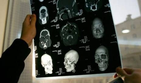 Face Transplantation Edges Toward Mainstream Medicine. Insurance Should Cover It