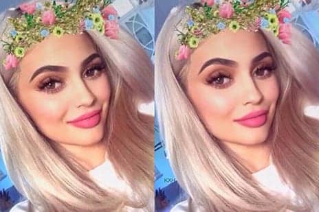 ‘Snapchat Dysmorphia’: Teenagers Are Getting Plastic Surgery to Look Like Selfie Filters