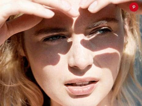 What You Should Know About Melasma
