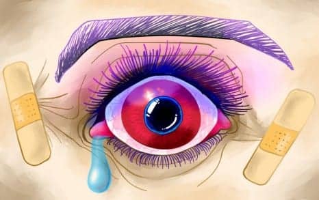 Lash Extensions Look Pretty But Can Have Ugly Consequences