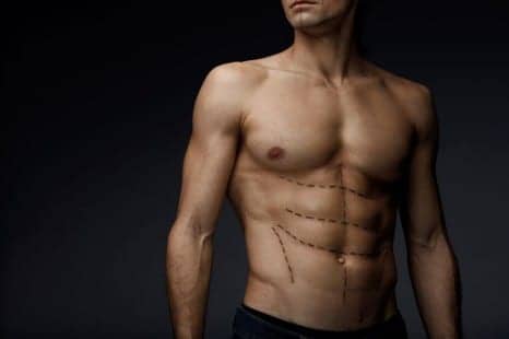 Why Guys Are Getting Butt and Chest Implants