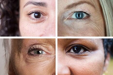 The Fix for Dark Circles, Bags and Droopy Lids