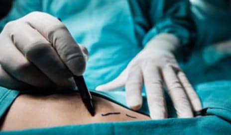 Putting Cosmetic Surgery on Your Plastic? Avoid These Complications