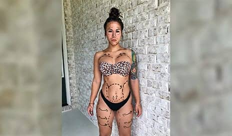 This Viral Photo Reveals the ‘Degrading’ Reality of Plastic Surgery