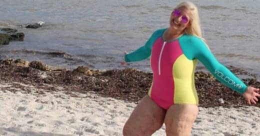 This Woman Dropped 350 Lbs—And Is Documenting Her Struggle With Excess Skin