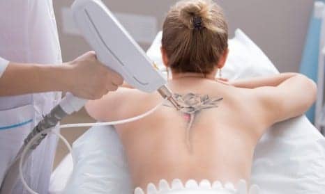 The 7 Most Common Tattoos Women Get Removed, According To Laser Surgeons